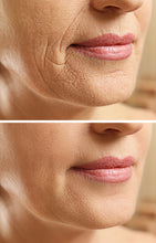 Flawless  - Super Wrinkle Treatment