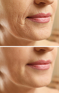 Flawless  - Super Wrinkle Treatment